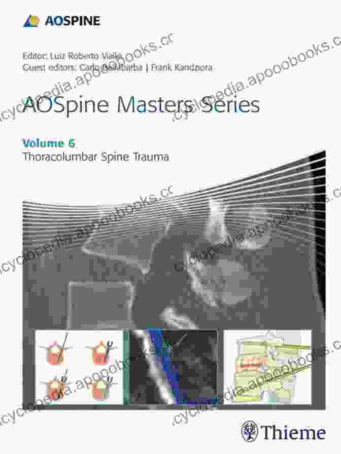 Aospine Masters Volume Thoracolumbar Spine Trauma Book AOSpine Masters Volume 6: Thoracolumbar Spine Trauma (AOSpine Masters 6)