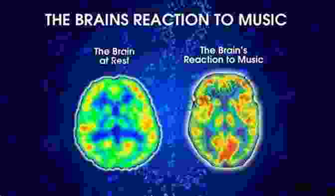 Brain Scan Showing Neural Activity During Music Listening Ways Of Hearing: Reflections On Music In 26 Pieces