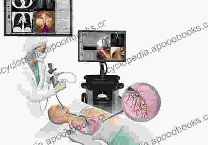 Bronchoscopy Procedure Advances In Interventional Pulmonology (Frontiers In Respiratory Medicine 1)