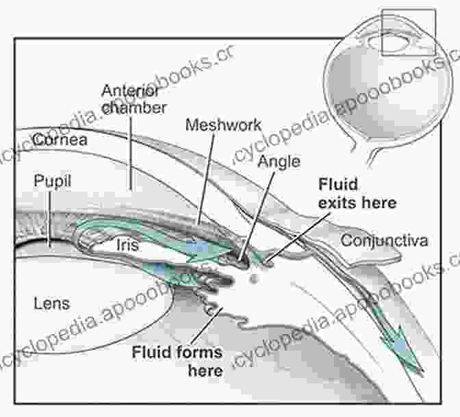 Diagram Of Intraocular Fluid Circulation Basic Sciences In Ophthalmology: Physics And Chemistry