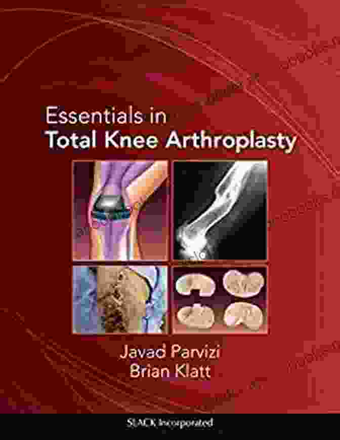 Essentials In Total Knee Arthroplasty: Parvizi's Essentials In Total Knee Essentials In Total Knee Arthroplasty (Parvizi Essentials In Total Knee Arthroplasty)