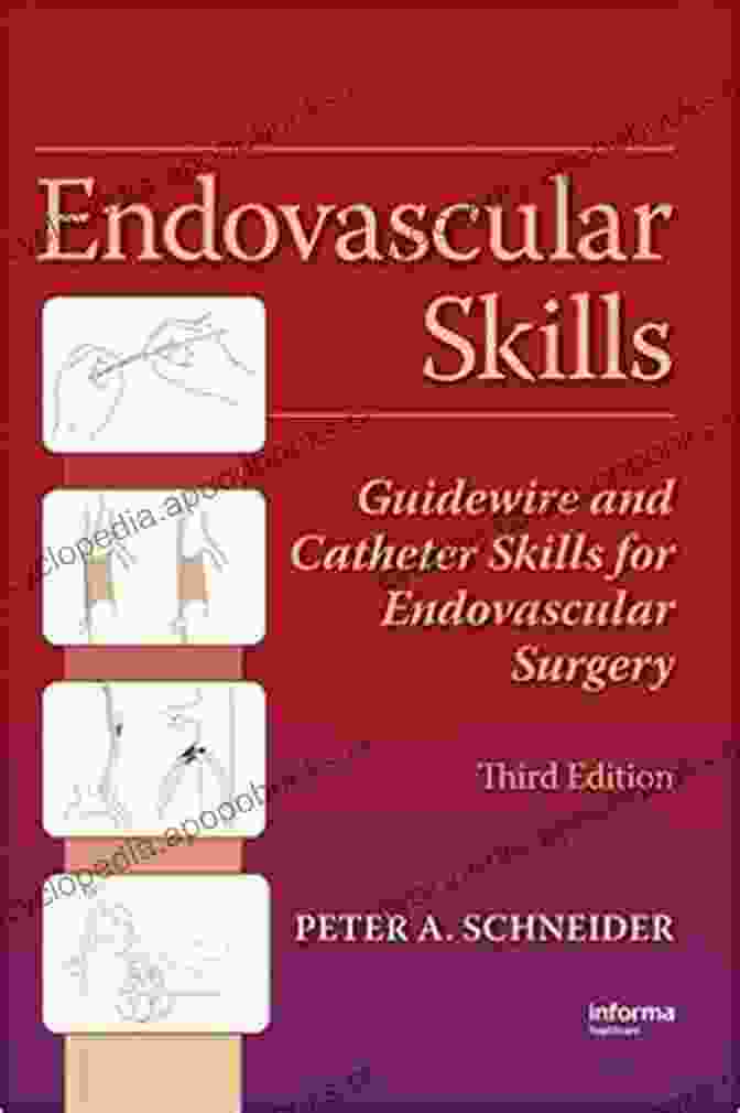 Guidewire And Catheter Skills For Endovascular Surgery Third Edition Book Endovascular Skills: Guidewire And Catheter Skills For Endovascular Surgery Third Edition