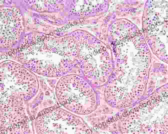 Histological Features Of Testis Tumours Histological Typing Of Testis Tumours (WHO World Health Organization International Histological Classification Of Tumours)