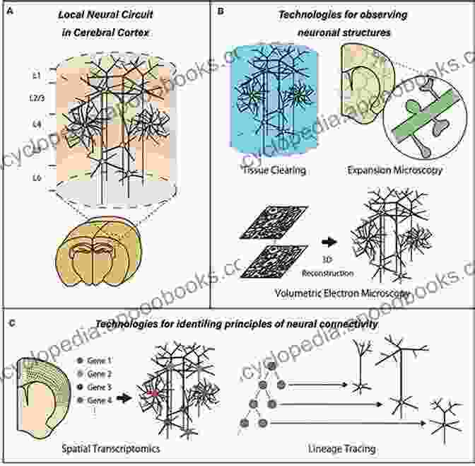 Neuronal Networks And Advanced Research In Neuroscience Carotid Artery Stenosis: Current And Emerging Treatments (Neurological Disease And Therapy 72)