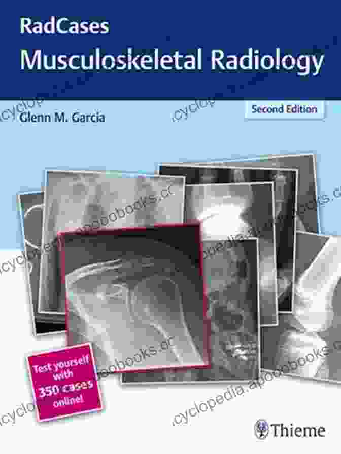 RadCases Musculoskeletal Radiology Book Cover Radcases Musculoskeletal Radiology (Radcases Plus Q A)