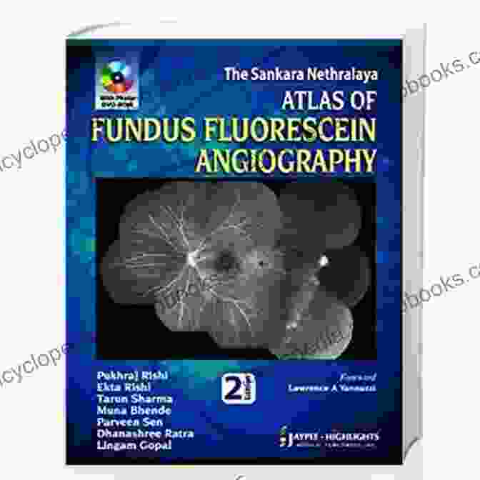 The Sankara Nethralaya Atlas Of Fundus Fluorescein Angiography Cover Image The Sankara Nethralaya Atlas Of Fundus Fluorescein Angiography