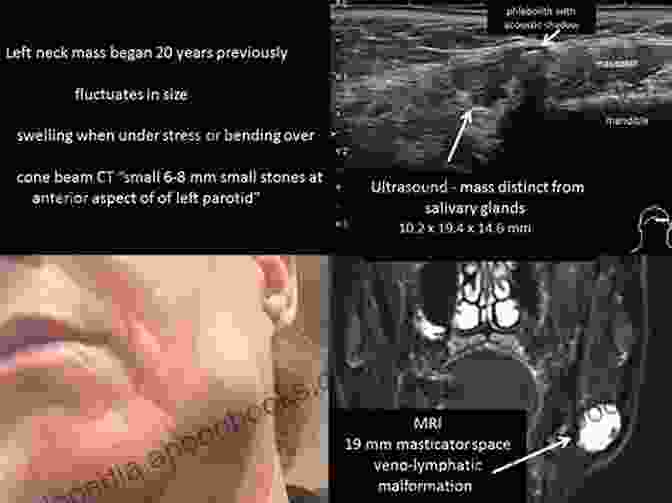 Ultrasonography Of The Head And Neck Ultrasonography Of The Head And Neck: An Imaging Atlas