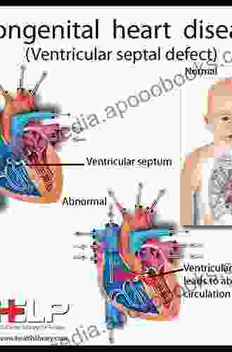 Congenital Heart Disease In Pediatric And Adult Patients: Anesthetic And Perioperative Management