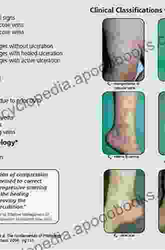 Phlebology Vein Surgery And Ultrasonography: Diagnosis And Management Of Venous Disease