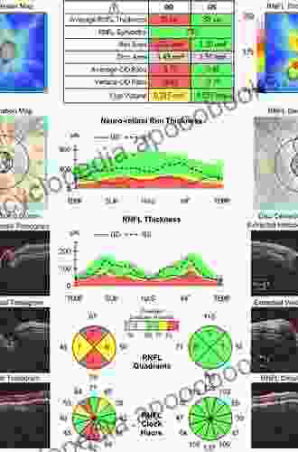 Optical Coherence Tomography In Glaucoma: A Practical Guide