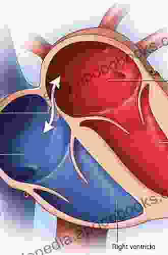 Patent Foramen Ovale