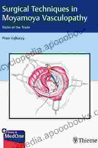 Surgical Techniques In Moyamoya Vasculopathy: Tricks Of The Trade