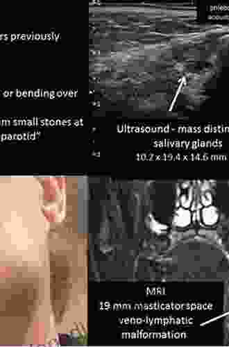 Ultrasonography of the Head and Neck: An Imaging Atlas