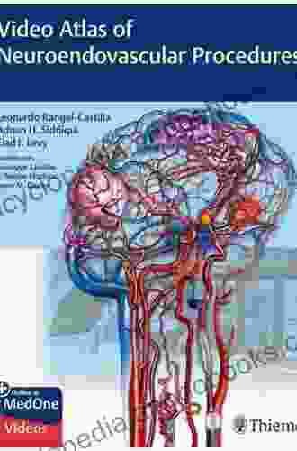 Video Atlas Of Neuroendovascular Procedures