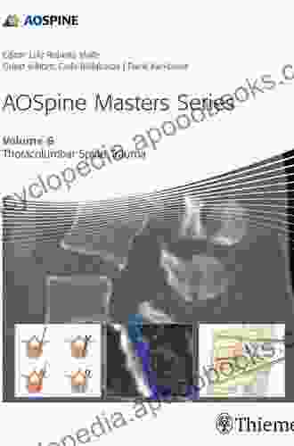 AOSpine Masters Volume 6: Thoracolumbar Spine Trauma (AOSpine Masters 6)