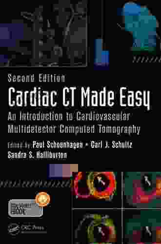 Cardiac Ct Made Easy: An Introduction To Cardiovascular Multidetector Computed Tomography